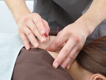 指圧はりきゅう堂 ハクト(Hakuto)