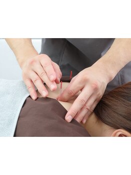 鍼灸施術を受けたい