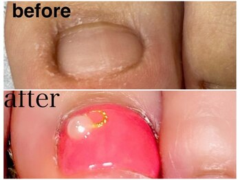 グレースレディ/アートもつけれます