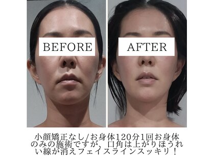 エクラリュクス アオヤマ(eclat Luxe AOYAMA)の写真