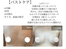 サロンツキ(salon tuki)/バストケア/症例