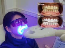 フェイシャルだけでないのが、TIARAの魅力☆ホワイトニングOK◎