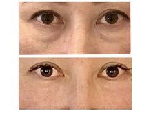 アイスパ プリンチ(EYE SPA PRINCCI)の雰囲気（ドライアイケアや目元たるみクマのケアに）