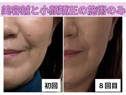 はまだ整体院の写真