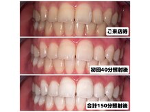 ライトビューティー 関内店(LIGHT BEAUTY)/[ 白い歯で自信のある笑顔へ ]