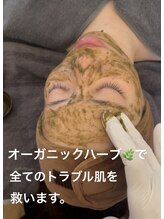 エステティックサロン グリーンアイ 浦和店(green.i)/小顔/たるみ/毛穴／レモンボトル