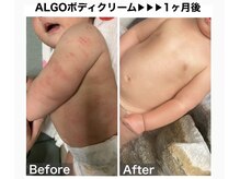 アルゴ 吹田千里山駅前店(ALGO)/マストで使う！ボディクリーム！