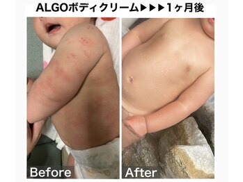アルゴ 吹田千里山駅前店(ALGO)/マストで使う!ボディクリーム!