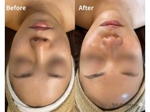 バリマ ビューティー(Bali Ma'beauty)/【小顔コルギ＆かっさ】