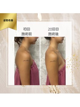 ロココ 町田店(Rococo)/巻き肩改善で美しい姿勢をGET!