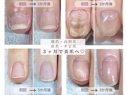 エマ(EMA)の写真