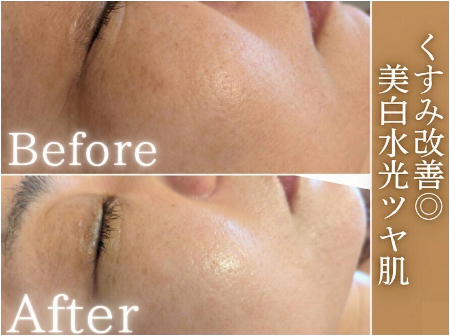 サロンドエステ ルヴニール(salon de esthe revenir)｜ホットペッパー