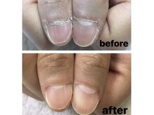 プライベートサロンエム(M)の雰囲気（【人気No. 1メニュー】自爪育成クリアジェルコース　¥6,000）