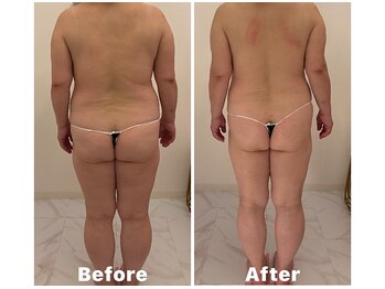 ビーハピネス 京都西院(B-Happiness)/後姿も超スッキリ！