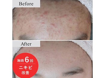 アールーム(Room)/