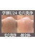 【学割U24】《学生限定|黒ずみ・角栓ごっそり》毛穴洗浄-顔全体-¥2750