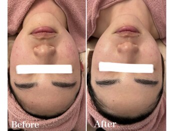 ヴィアージュ(Viage)/