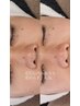 【Mona担当】¥リピート率No.1/"毛穴洗浄×眉WAXケアSET" ¥9,000