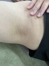 ナノハナ/鹿沼市全身脱毛美容室ナノハナ