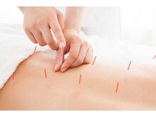 骨盤スタイル鍼灸整骨院 武蔵新城院(骨盤STYLE鍼灸整骨院)/鍼灸施術