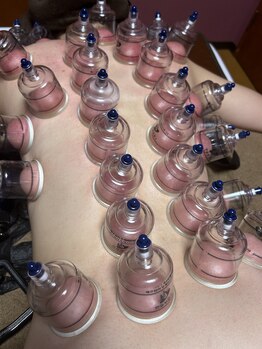 ビマリア(美-MARIA)/カッピング