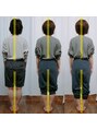 サンイチゼロ(310) 矯正を重ねる度、骨盤が締まりやすくなり美しくくびれました