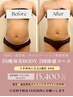 まずは体感！30%OFF 3S痩身プロ上半身美背中美ボディ大変身【2回コース】