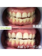 ルブラン 奈良店(Le Blanc)/凛とした輝き