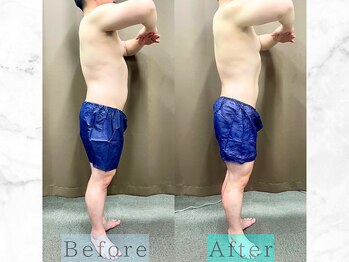 パラディ(PARADIS)/ハイパーナイフ/シェイプ