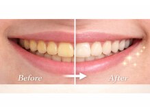 シャイニー 掛川店(shiny)/