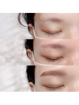 リヨン(LYON+831)/