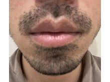 ロイビー(loeyB)/濃いヒゲ