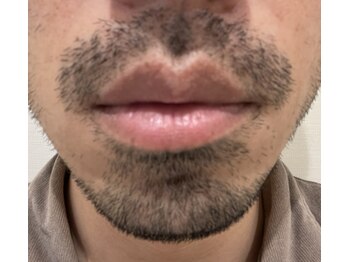 ロイビー(loeyB)/濃いヒゲ