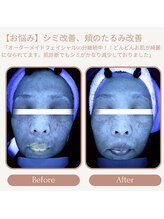 プリマジュール/肌質診断機でもこの変化！