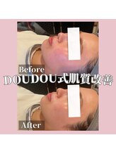 サロンドゥードゥー(SALON DOUDOU)/【肌にアプローチ】CHRISTINA