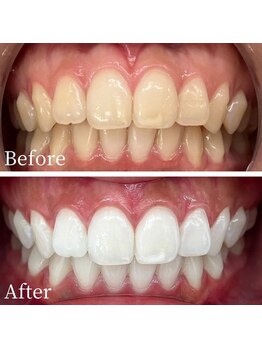 ホワイト 富山店(WHITE)/-３か月通い放題【無加工】-