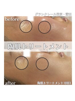 グランクレール トウキョウ(GRANDCLAIRE.TOKYO)/陶肌トリートメント