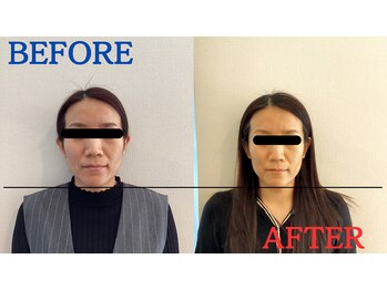 たかす整骨院/エラ/小顔/腰痛/肩こり