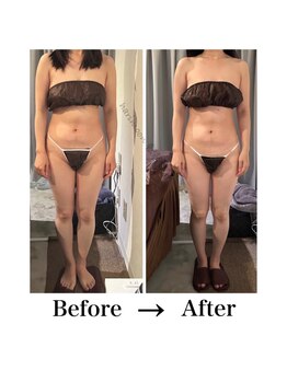 ハリムーン 仙台(harimoon)/くびれも足もすっきり!