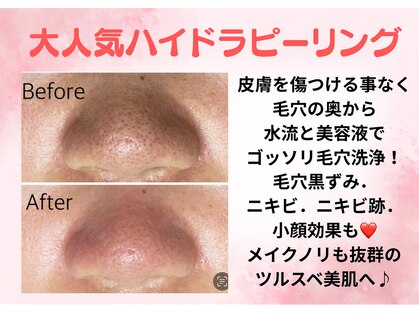 ルアナ(Ruana)の写真