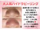 ルアナ(Ruana)の写真