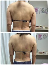 アスピリア(aspirer a')/上半身痩身でスッキリ！