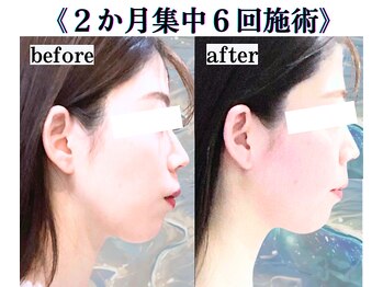 ボナボナ 仙台立町(BONA BONA)