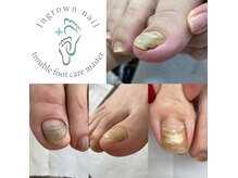 どこに相談したら良いかわからない爪の悩みも対応可