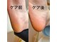 ココミ(kokomi)の写真