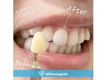 ホワイトニングカフェ 綾瀬店(WhiteningCafe)の雰囲気（ホワイトニングの症例写真はフォトギャラリー・ブログをCheck！）