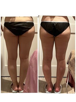 プリヴィエレジェ(privilegie)/