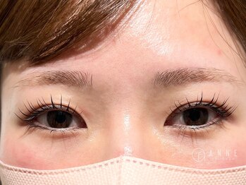 アンネ 東心斎橋店(ANNE)/モンテラッシュリフト