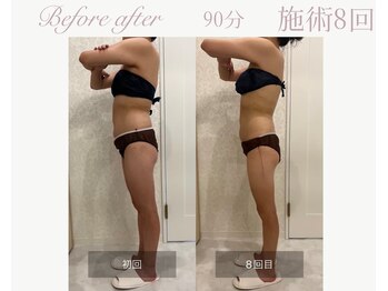 パルタージュ(Partage)/デトックス痩身エステ