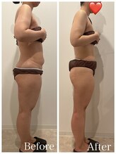 まろん鍼灸接骨院 立川店/痩身エステ（下半身）